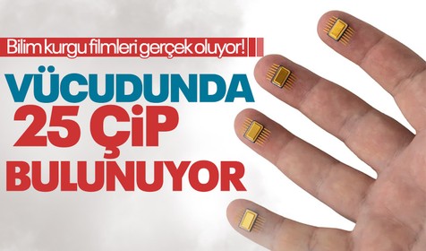 Bilimkurgu filmleri gerçek oluyor! Derisinin altına 25 çip yerleştirdi