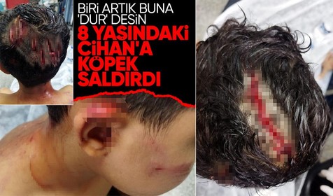 Gaziantep'te köpek saldırısına uğrayan talihsiz çocuğun kafatasına 25 dikiş atıldı