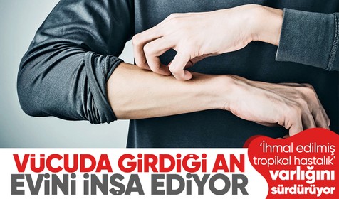 İnsan vücuduna girdiği an yayılıp evini inşa ediyor! Pandemi sonucu yüzde 50 arttı