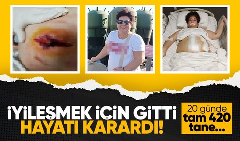 Dört hastasının ölümünden sorumlu olan doktor, kadının hayatını kararttı! 20 günde tam 420 dikiş atıldı..."Hayatımı elimden aldı"