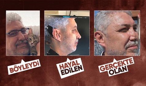 Doktor arkadaşına güvenen iş insanının hazin sonu! Burnu öyle bir hale geldi ki...