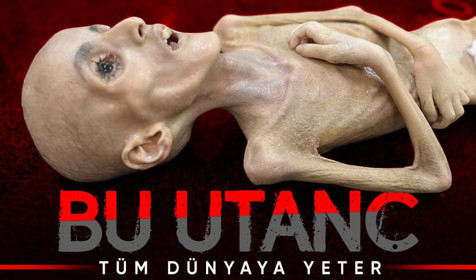 Gazze'de boğazları düğümleyen olay! 10 yaşındaki çocuk bir deri bir kemik halde açlıktan öldü
