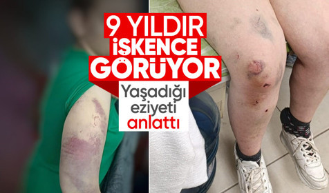 9 yıldır karısına eziyet uygulayan koca tutuklandı