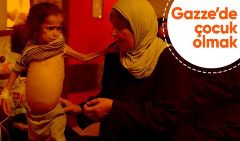 Gazze'de çocuklar açlık nedeniyle ölümle boğuşuyor