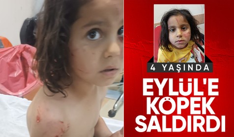 Şanlıurfa'da köpeklerin saldırdığı 4 yaşındaki Eylül yaralandı
