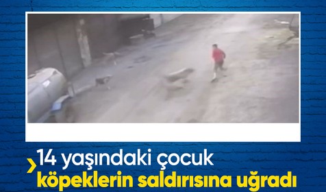 Adana'da 14 yaşındaki çocuk başıboş köpeklerin saldırısına uğradı