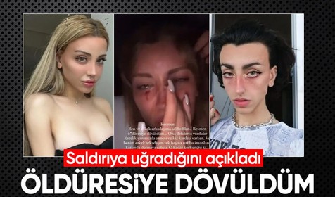 Sosyal medya fenomeni Mika Can Raun saldırıya uğradığını açıkladı: "Öldüresiye dövüldüm"