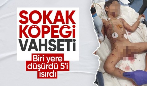 Sokak köpeklerinin saldırısına uğrayan çocuk ağır yaralandı