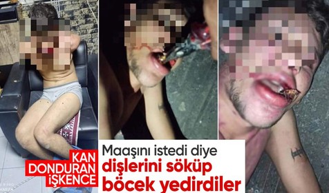 Antalya'da kan donduran olay! Maaşını istedi diye dişlerini kerpetenle söküp böcek yedirdiler