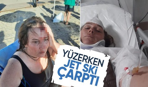 Darıca'da bir kadına denizde yüzerken jet ski çarptı