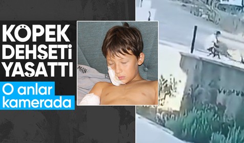 Taş attığı köpek zinciri kırarak dehşeti yaşattı, o anlar kamerada