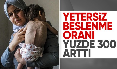 Gazze'deki çocuklarda yetersiz beslenme oranı yüzde 300 arttı