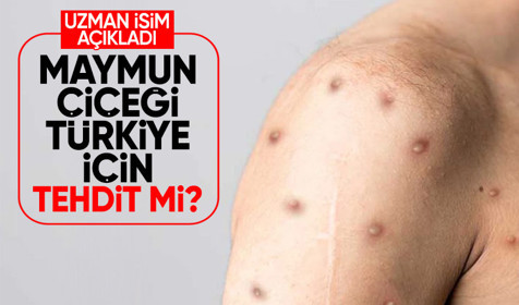 Maymun çiçeği Türkiye için tehdit mi? Profesör Şevket Özkaya'dan açıklama
