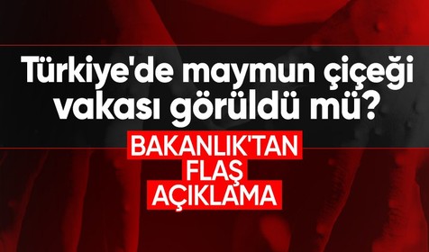 Sağlık Bakanlığı'dan açıklama Türkiye'de maymun çiçeği görüldü mü?