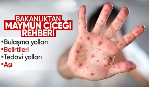 Sağlık Bakanlığı, maymun çiçeği virüsü rehberi yayımlandı! Nasıl bulaşır, tedavi yolları nelerdir?
