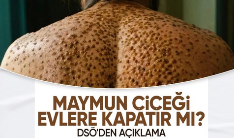Maymun çiçeği virüsü evlere kapatır mı? DSÖ'den açıklama