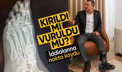 Özgür Özel'den 'Vuruldu' iddilarına sert tepki! Ayağındaki kırıkların filmlerini paylaştı