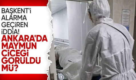 Ankara'yı alarma geçiren iddia! Maymun çiçeği görüldü mü? Yetkililerden açıklama