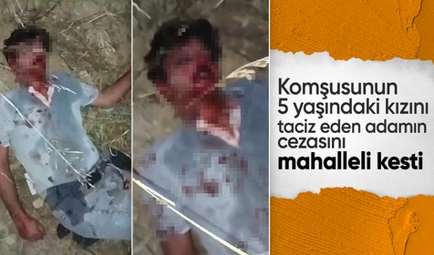 Çocuğu taciz etmeye çalışan şahsı hastanelik ettiler
