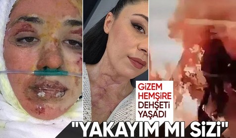 Hastanede alev alev yanan Gizem Hemşire dehşet gününü anlattı: Yakayım mı sizi