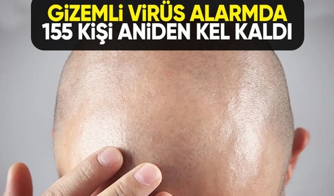 Hindistan’da gizemli salgın: 155 kişi aniden saçlarını kaybetti