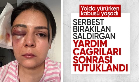 Kahramanmaraş'ta korkunç olay! Gözü dönmüş adam yoldan geçen kıza yumruk atıp gözünü morarttı!