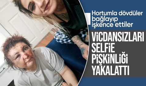 Ankara'da bir kadını zorla alıkoyup, darp eden 2 şüpheli tutuklandı