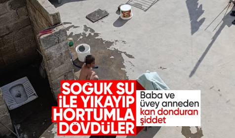 Baba ve üvey anneden kan donduran şiddet: Soğuk su döküp hortumla dövdüler