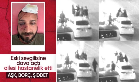 'İcraya verdiği eski sevgilisinin ailesi tarafından öldüresiye darp edildiğini' iddia etti: Görüntüler ortaya çıktı