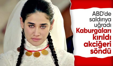 Oyuncu Meltem Miraoğlu ABD'de saldırıya uğradı: Kaburgaları kırıldı
