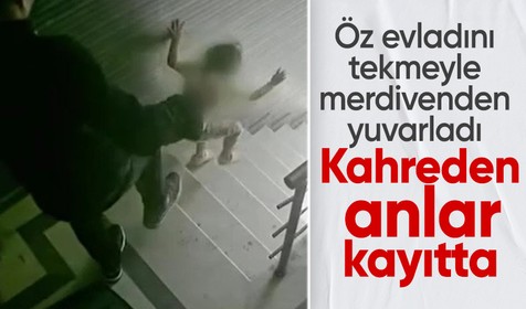 Eyüpsultan'da babasının tekmeyle merdivenden yuvarladığı çocuk ağır yaralı