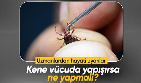 Sakın dokunmayın! Kene vücuda yapışırsa ne yapmalı, nasıl çıkarılmalı?