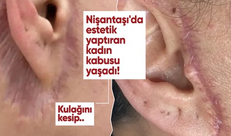 Nişantaşı'da estetik yaptıran kadın kabusu yaşadı! Kulağını kesip...