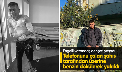 Engelli vatandaş dehşeti yaşadı: Telefonunu çalan şahıs tarafından üzerine benzin dökülerek yakıldı