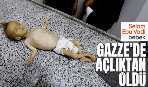 Gazze'de Selam Ebu Vadi açlıktan öldü