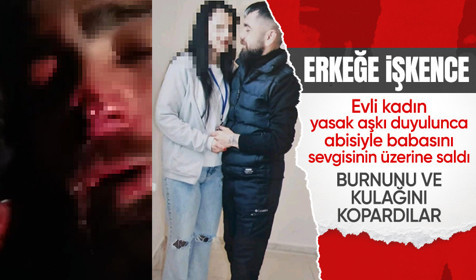 Yasak aşk yaşayıp ayrıldığı adama cehennemi yaşattı! Kulağını ve burnunu kopardılar