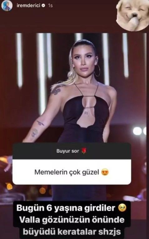 Ünlü şarkıcı İrem Derici'den takipçisinin "Memeleriniz çok güzel" yorumuna bomba gibi yanıt! "Gerçek değiller çünkü..." - Resim: 5