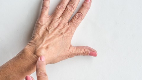 Sürekli el bileğinin kullanılması gereken mesleklerde ganglion kistinin daha sık görüldüğünü belirten uzman uyardı!