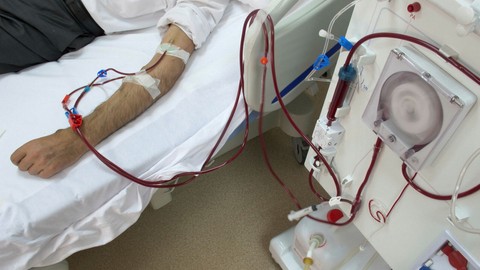 Diyaliz sonrası tedaviye alınan hastalarda ikinci ölüm