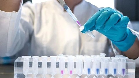 İzmir’de 13 yaşındaki çocuk AIDS’ten hayatını kaybetti