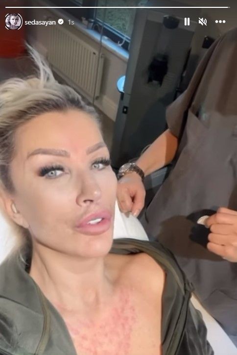 'Ben çorap kadınıyım' sözleriyle damga vuran Seda Sayan son dönemin popüler sünnet derisi operasyonunu yaptırdı! - Resim: 15