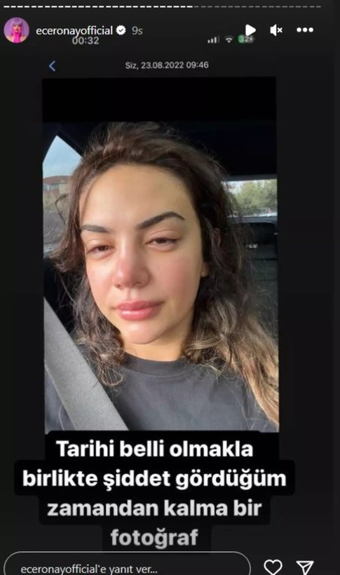 Ece Ronay 'İntihar etti derlerse inanmayın' diyerek duyurdu! Şiddet gördüğünü kanıtıyla paylaştı - Resim: 9