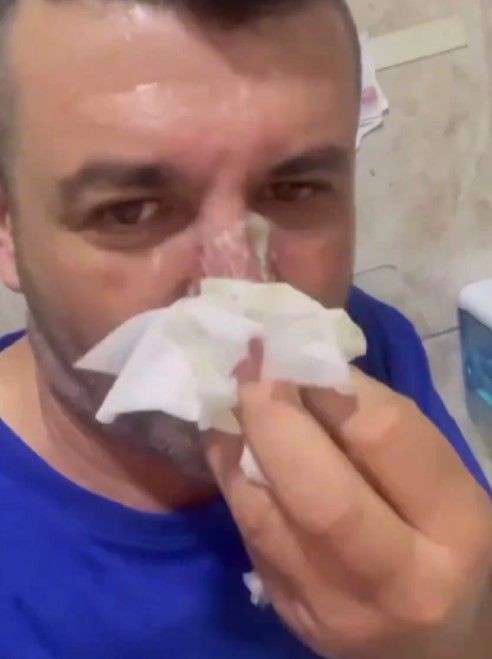 Yaralı köpeği beslerken saldırısına uğradı! Doktorun sözlerine rağmen tek derdi bakın ne oldu - Resim: 3