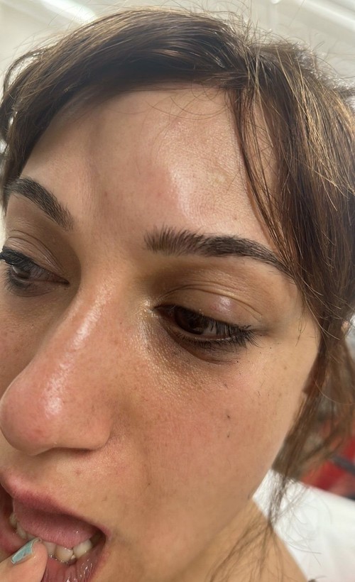 Bu defa şiddet doktordan! Taksim'de gözü dönen doktor kadını yumrukladı! O anlar kamerada - Resim: 2
