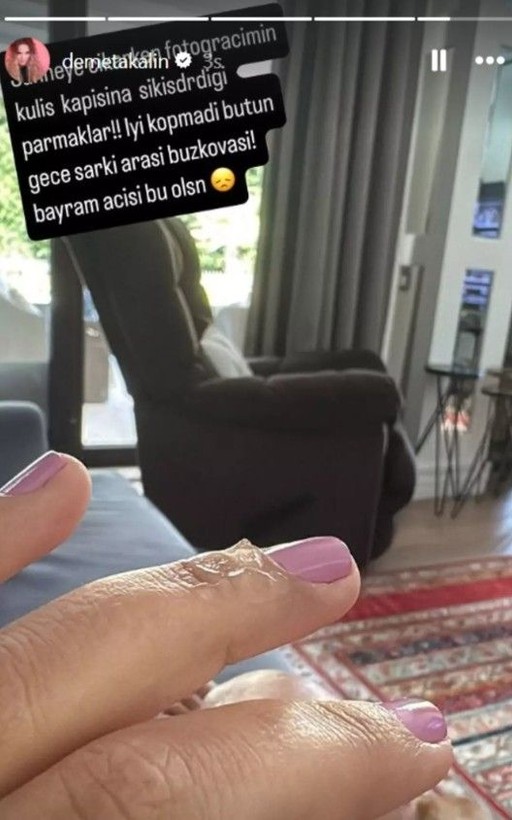 Demet Akalın konser öncesi talihsiz bir kaza geçirdi: İyi ki kopmadı - Resim: 4