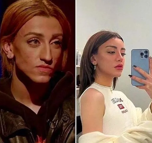 Geçirdiği estetik operasyonlarla gündeme bomba gibi düşen Mika Raun'un gizemli sevgilisinin yüzü göründü! - Resim: 5