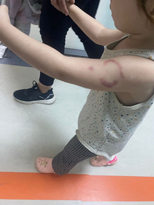 Edirne'de öğrencisini ısıran öğretmen tutuklandı - Resim : 2