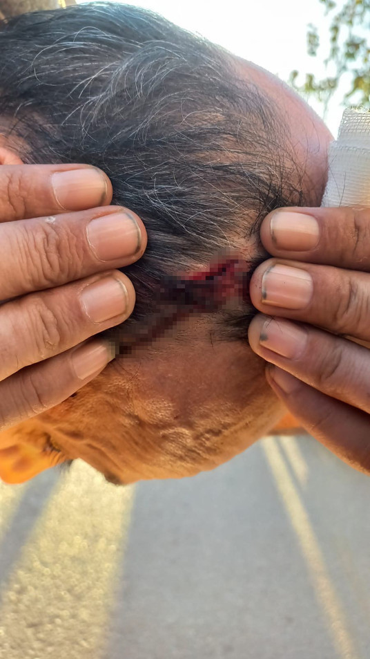 Kartal'da taksimetre kavgası! Soyunurum diyen kadın şoförün kafasına vurdu - Resim : 1