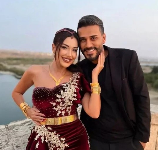 Dilan Polat Esra Balamir'in kendisi hakkında yaptığı şoke eden açıklamalardan sonra açtı ağzını yumdu gözünü... "Allah'ından bulsun" - Resim: 2