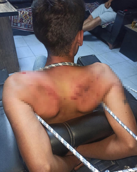 Böcek yedirip, dişlerini kırmışlardı! Savcının istediği ceza belli oldu - Resim : 4